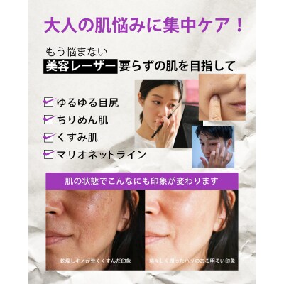 【MARK AID】エクソスピキュールクリーム【エクソソーム針クリーム】