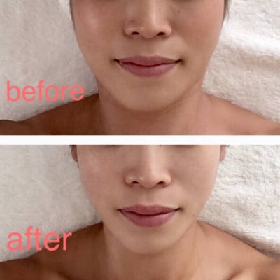【女性限定】フェイシャルエステ 体験チケット 1回分