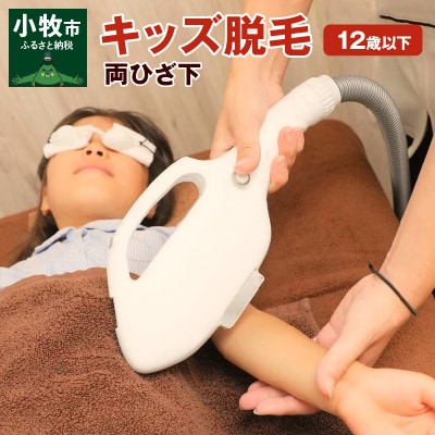 キッズ(12歳以下)脱毛　両ひざ下[070F03]