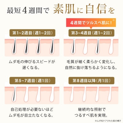 FASCINATEBEAUTY IPL光美容器 EPIFLASH FN-IPE010-W