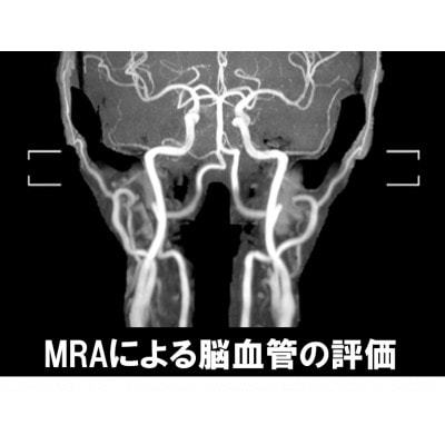 浜松市　浜松PET診断センター　簡易脳ドック受診券