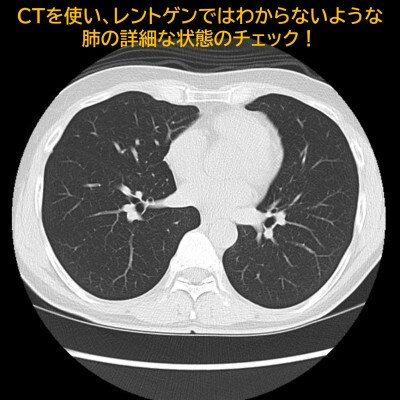 浜松市　浜松PET診断センター　肺がんCT検診受診券