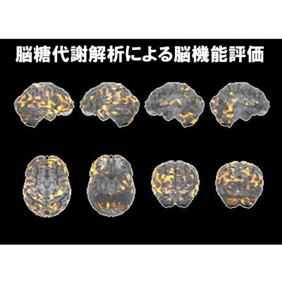 浜松市　浜松PET診断センター　PET認知症検診・FDGコース受診券