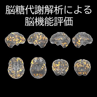 浜松市　浜松PET診断センター　PETがん検診/総合コース+脳オプション受診券