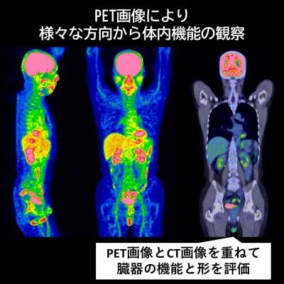 浜松市　浜松PET診断センター　PETがん検診/総合コース受診券