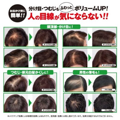利尻フィットスプレー糸島市/株式会社ピュール[AZA077]
