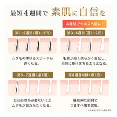 脱毛器 FASCINATEBEAUTY FN-IPE010-W[53753530]