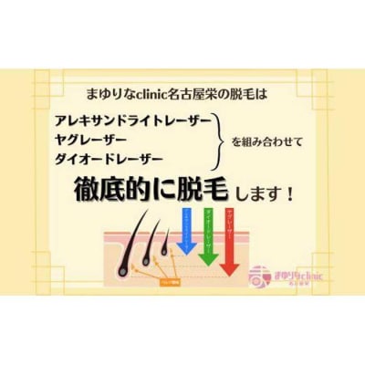 【男性医療脱毛】ひげ　5回コース