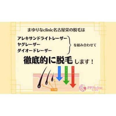 【男性医療脱毛】全身(VIO・顔除く)5回コース