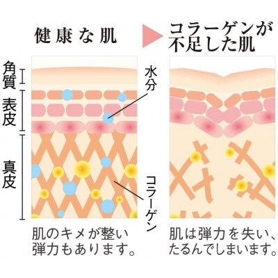 コラーゲン×2本(20988)