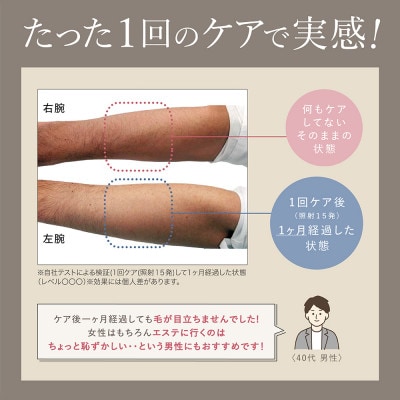 LINKA リンカ エピゼロ IPL光脱毛器