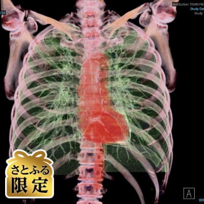 【さとふる限定】「天理発　3D　CT　画像健診」