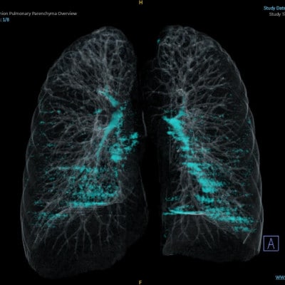 【さとふる限定】「天理発　3D　CT　画像健診」
