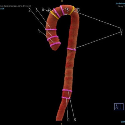 【さとふる限定】「天理発　3D　CT　画像健診」
