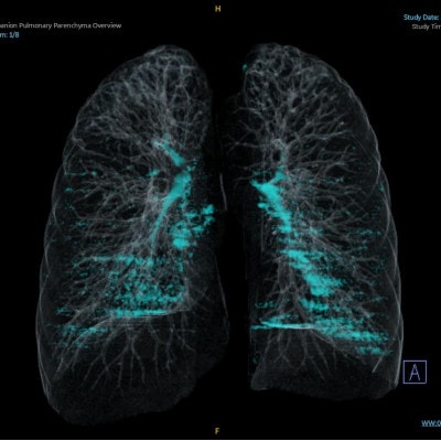 天理発  3D CT ( 頚部 ～ 骨盤 )+胆・肝・膵 MRI 健診