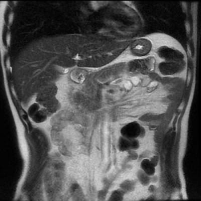 天理発  3D CT ( 頚部 ～ 骨盤 )+胆・肝・膵 MRI 健診