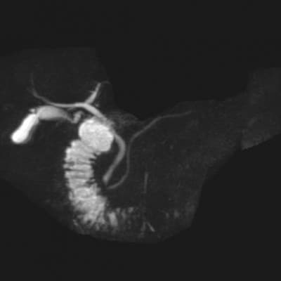 天理発  3D CT ( 頚部 ～ 骨盤 )+胆・肝・膵 MRI 健診