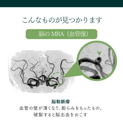 身体の健康診断を受けるなら、脳の状態も知っておいた方がいい!約30分で終わる日帰り脳ドック!