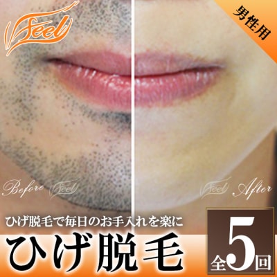 【男性】ひげ脱毛(全5回)体験チケット