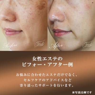 エステ利用券10,000円(全メニューに使用可)