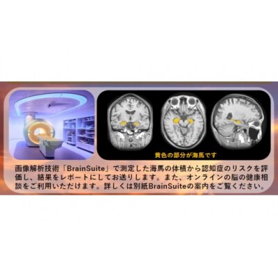 【贈り物にも】トワイライトドック～夕方からの脳の健康診断～